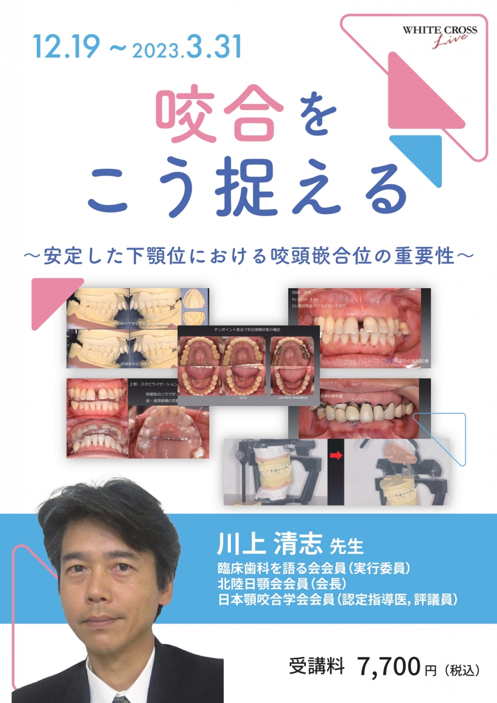 [VOD]咬合をこう捉える WHITE CROSS